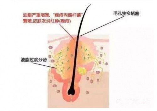 男主播诱导13岁女孩3个月打赏46万，网络世界的诱惑与反思